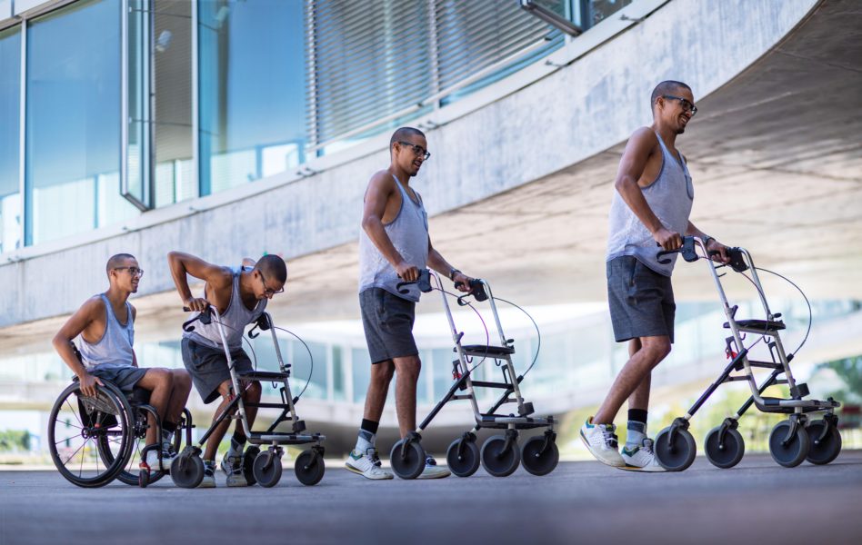 E-stimulation helps patients with incomplete spinal injury walk again